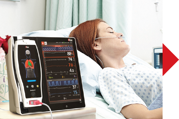 Masimo - Configurare soglie allarmi - donna in letto ospedaliero con dispositivo