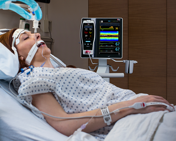 Paziente monitorato con SedLine e O3 su Root in PACU