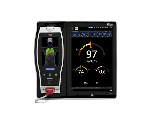 Sistema di monitoraggio paziente Root con Radical-7 ancorato.