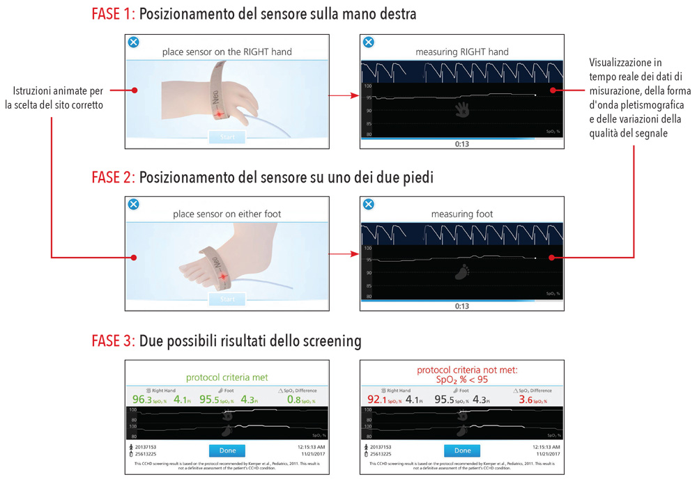 Masimo - Le istruzioni dettagliate di Eve migliorano la coerenza e l'efficienza del flusso di lavoro