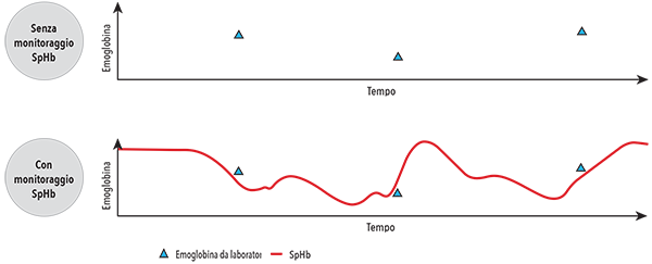 Masimo - SpHb - Diagramma di monitoraggio del valore di SpHb