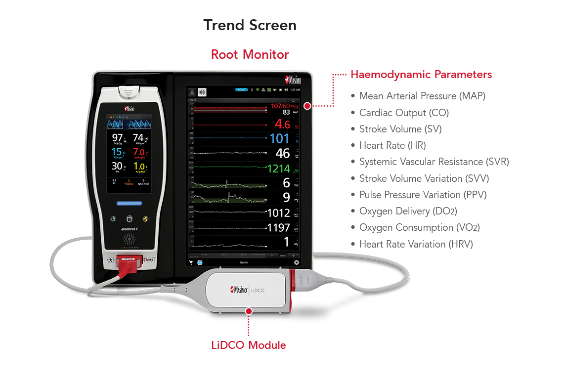 Principali caratteristiche di LiDCO sul monitor di visualizzazione Root