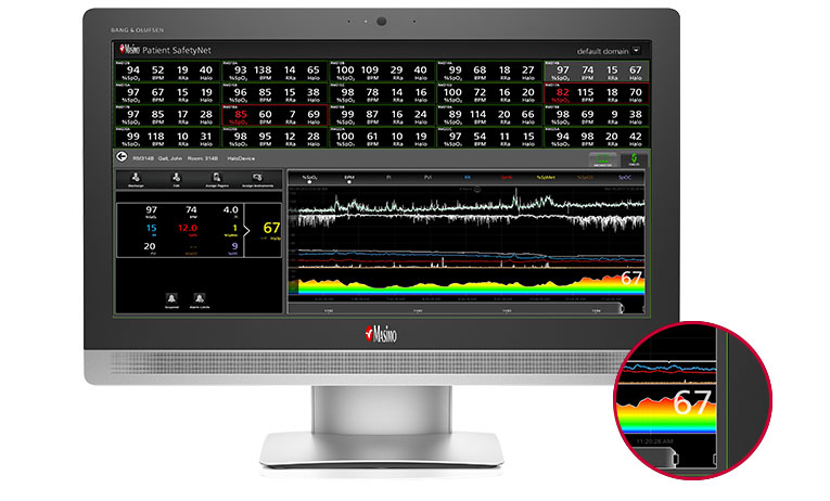 Masimo ‑ Halo Index