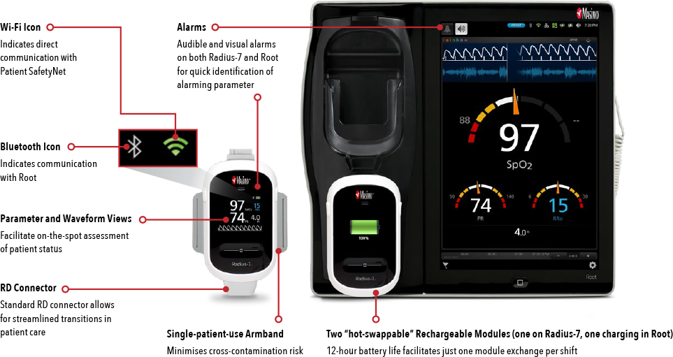 Masimo - Didascalie di Radius-7