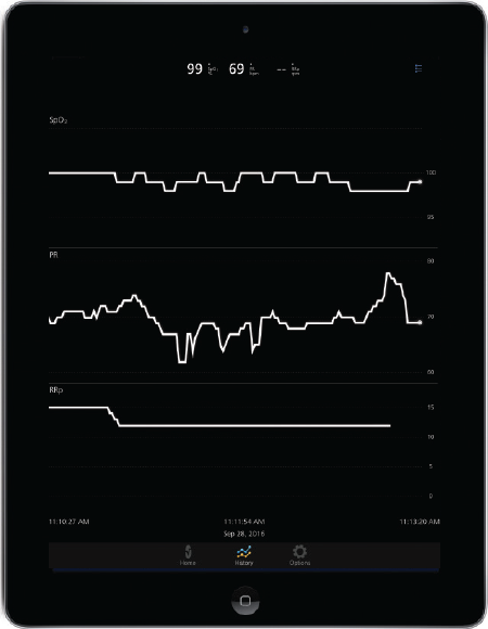 Masimo - Dati dei trend sull'app Masimo Professional Health