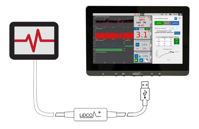 Sistema di monitoraggio LiDCO con cavo di collegamento al lettore