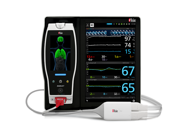 Masimo - Ossimetria regionale O3®