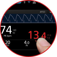 Masimo - Rad-97 Visualizzazione personalizzabile della capnografia