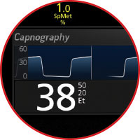 Masimo - Rad-97 con capnografia