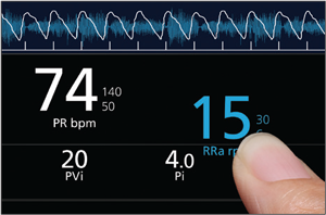 Masimo - Rad-97 - Customisable display