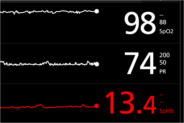 Rad-97 display showing SpO₂, pulse rate, and hemoglobin levels with corresponding waveform traces.