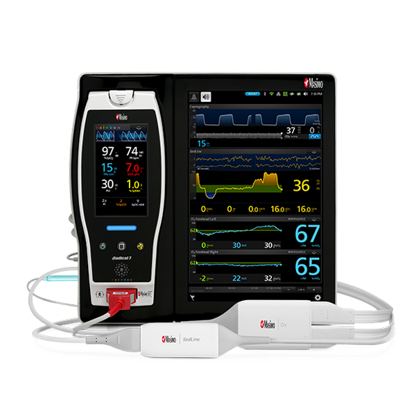 Masimo - Piattaforma Root Monitoraggio continuo