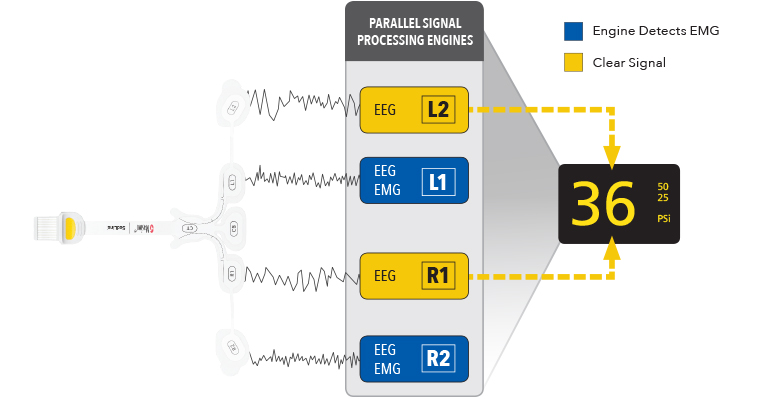 Masimo - Motori paralleli di elaborazione dei segnali