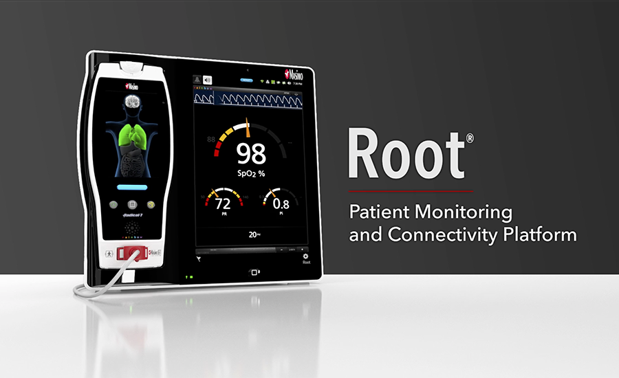 Anteprima del video di Root