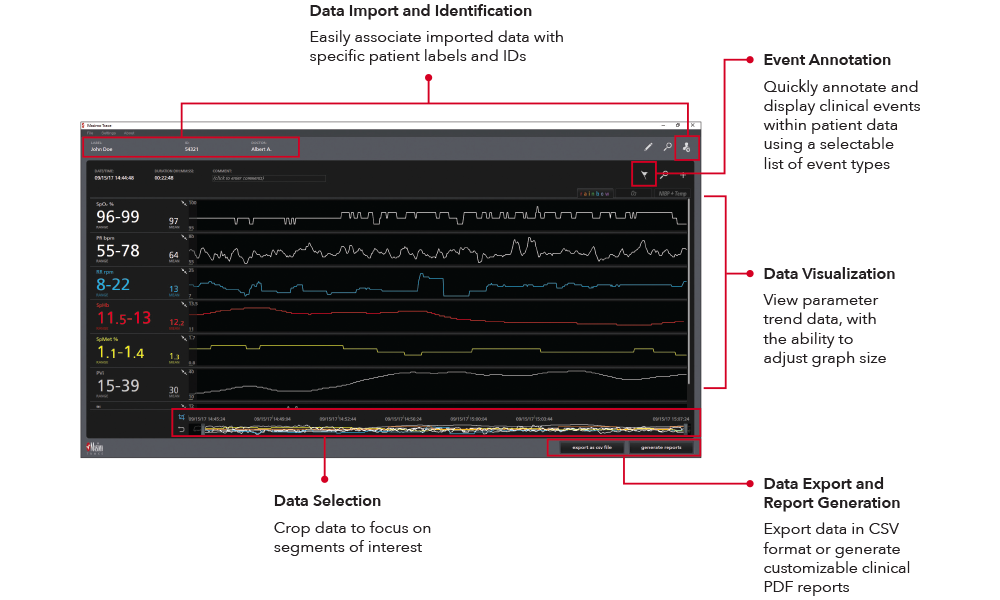 Masimo - Trace - Visualizzazione dati