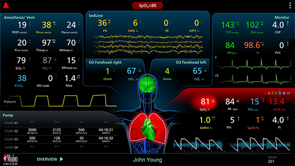 Masimo - UniView - Layout Panoramica