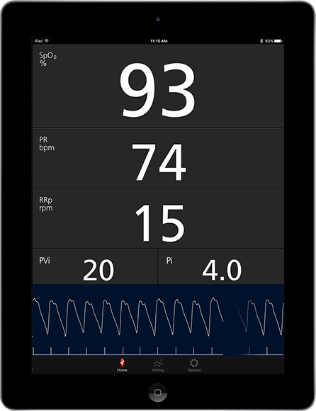 Masimo - Misurazioni visualizzate sull'app Masimo Professional Health