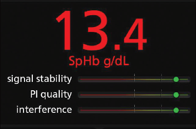 Masimo - Rad-67 - Visualizzazione dei risultati dei controlli sporadici