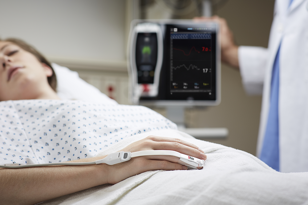 Paziente addormentato in un letto d'ospedale con monitor Masimo al dito e dispositivo Root Masimo sullo sfondo.